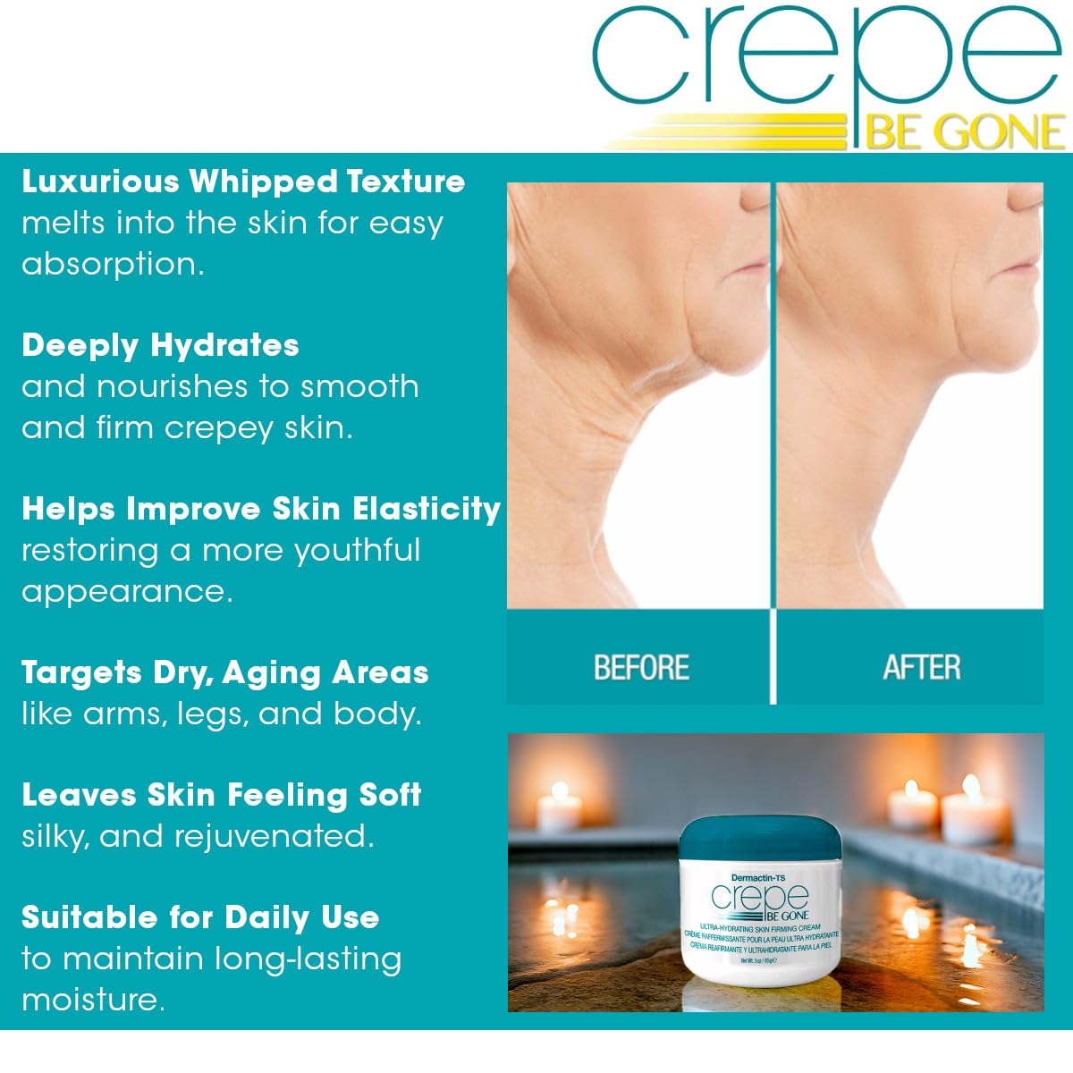 Dermactin Crepe Be Gone Body Souffle on leg shows daily moisture and firmness.