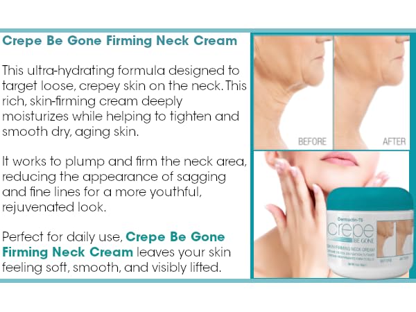 Closeup of Dermactin Crepe Be Gone packaging and lid