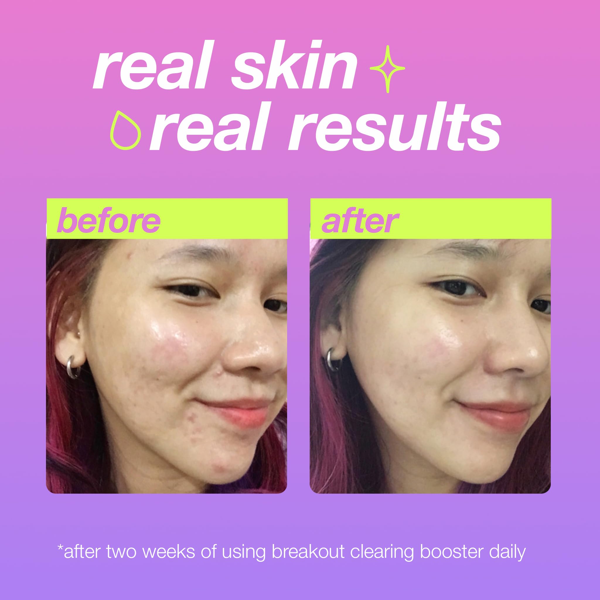 Dermalogica Clear Start Booster Niacinamide ingredient closeup supports skin tone and barrier.