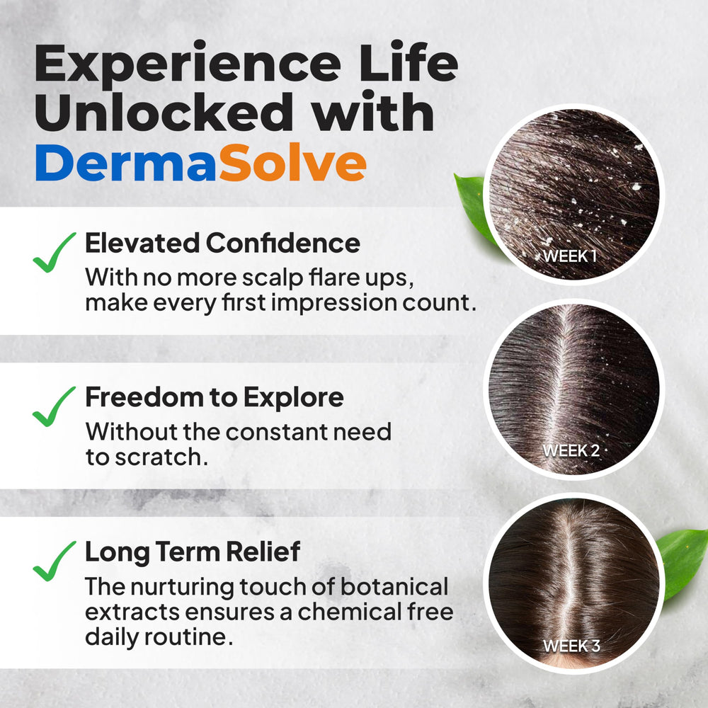 Calendula extract soothing the scalp in Dermasolve
