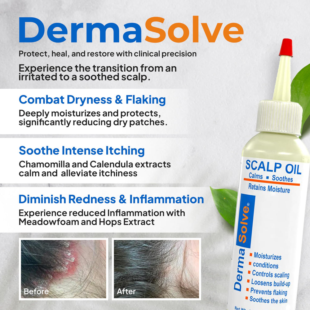 Dermasolve scalp oil being poured for quick absorption