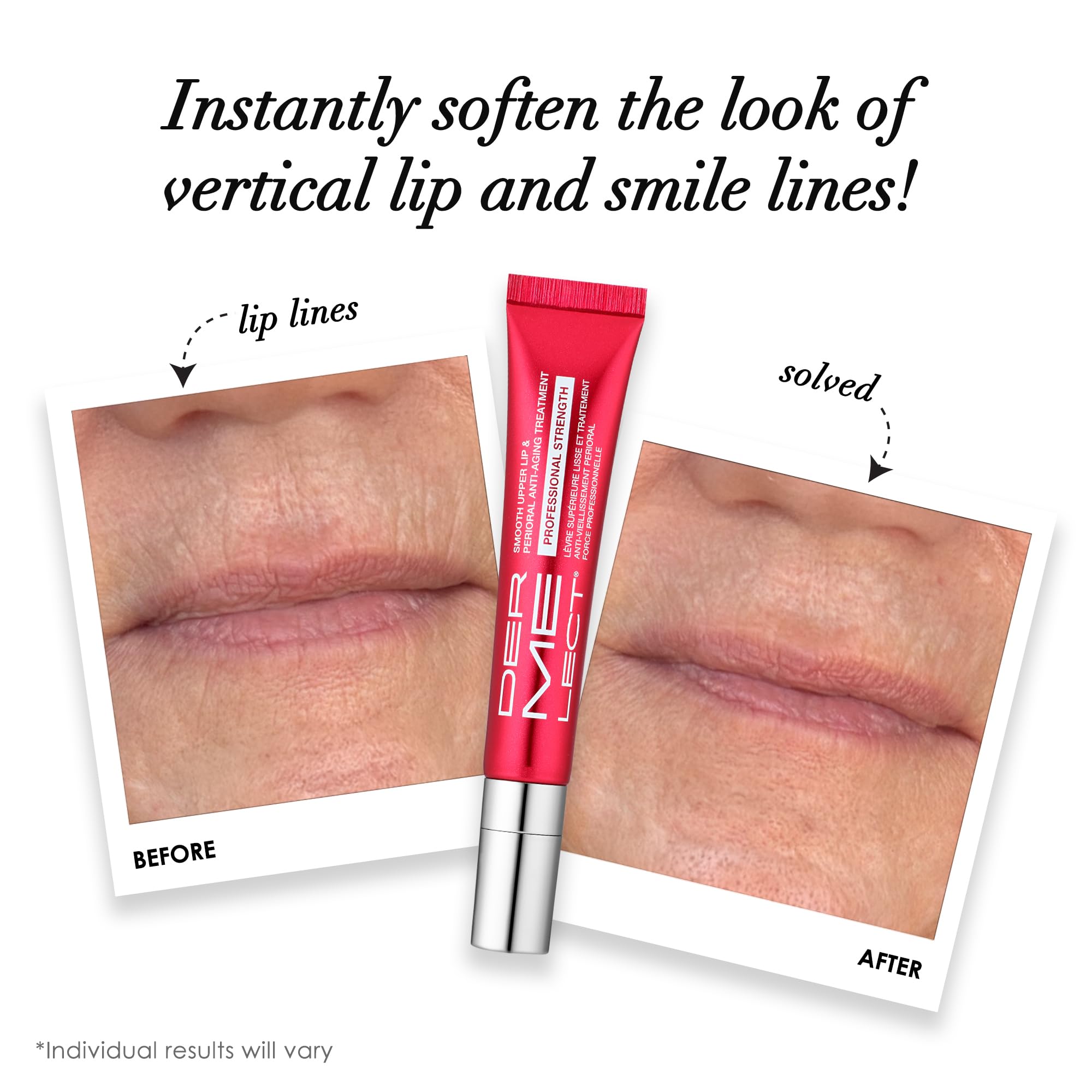 Dermelect applicator tip close-up enabling precise lip treatment and primer application