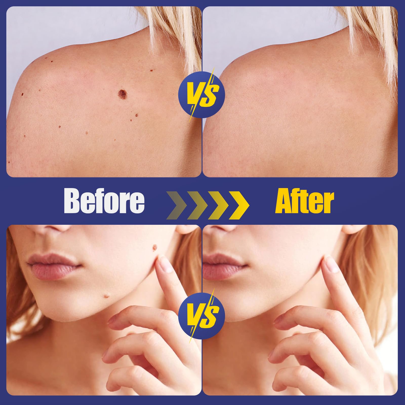 DERMFREE transparent patch blends with skin for comfortable wear.