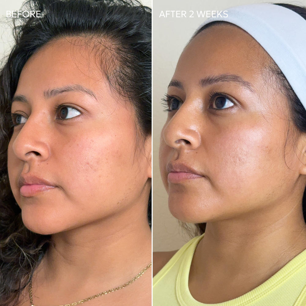 Dermisa Skin Fade Cream in daily routine setup suggests consistent use for brighter results.