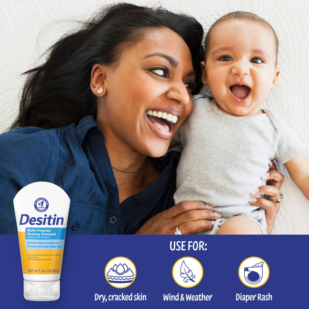 Person applying Desitin on dry hands to prevent chapping in cold weather.