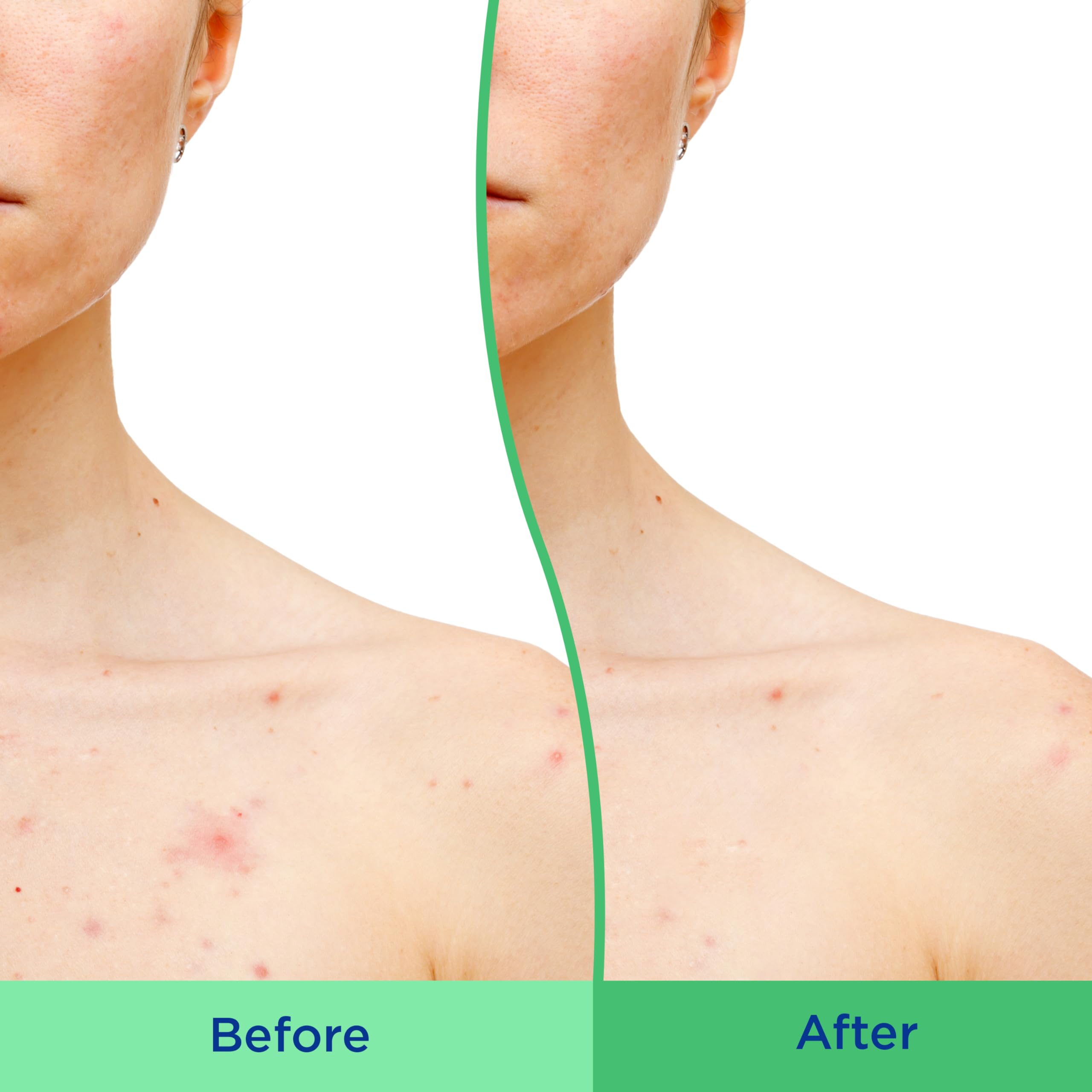 Differin Body Scrub exfoliating beads visible for gentle cleansing.