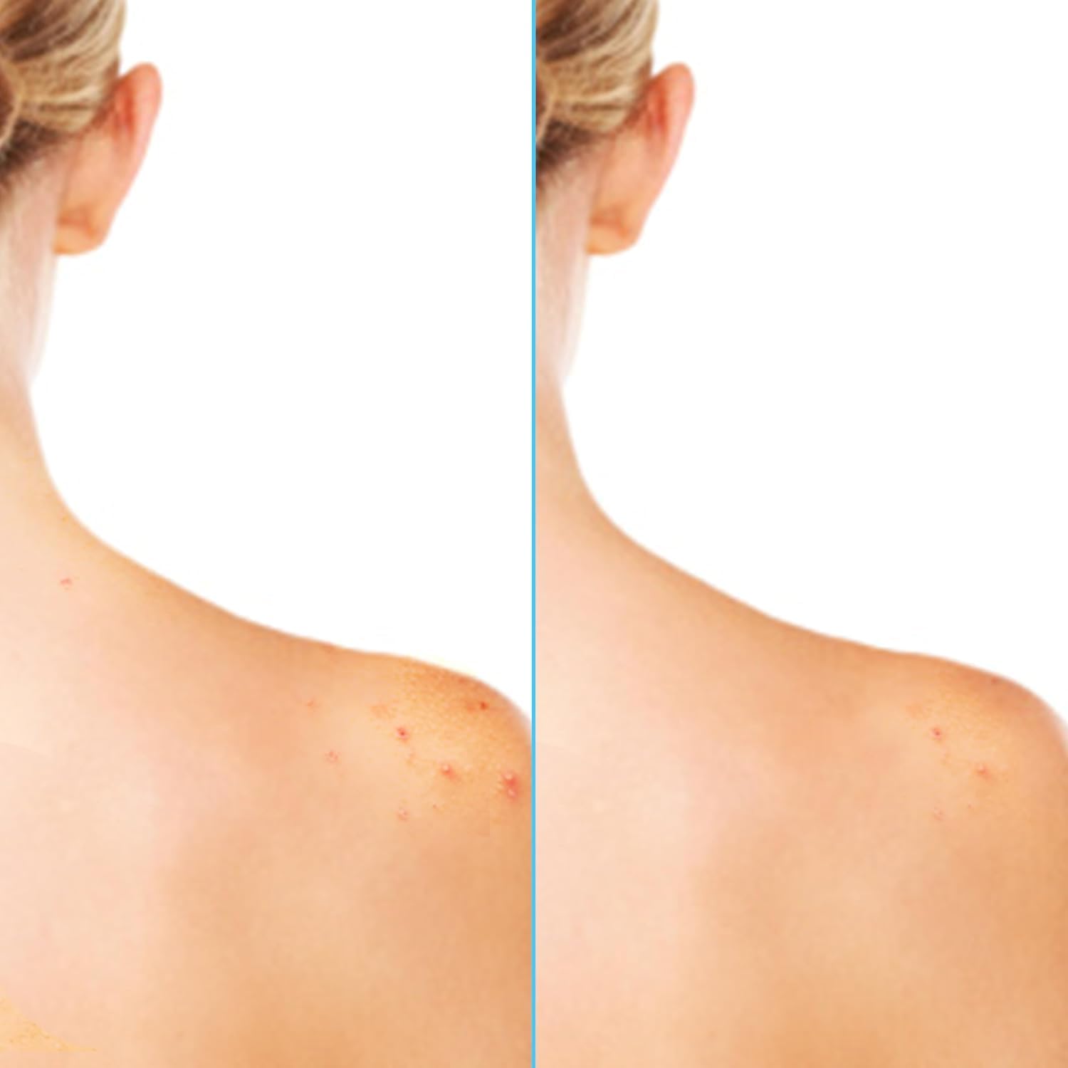360° spray reaches neck-to-toes for comprehensive body coverage.