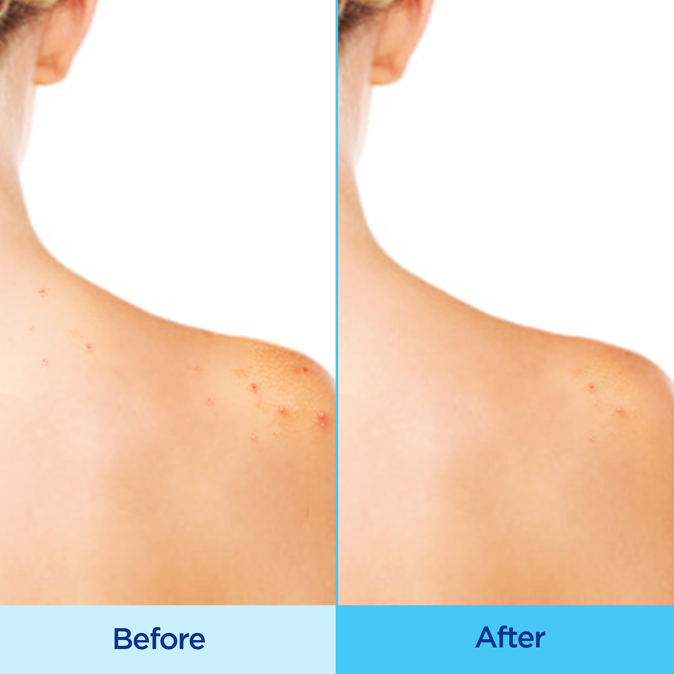 Back shoulder use with 360° spray for thorough coverage during workouts.