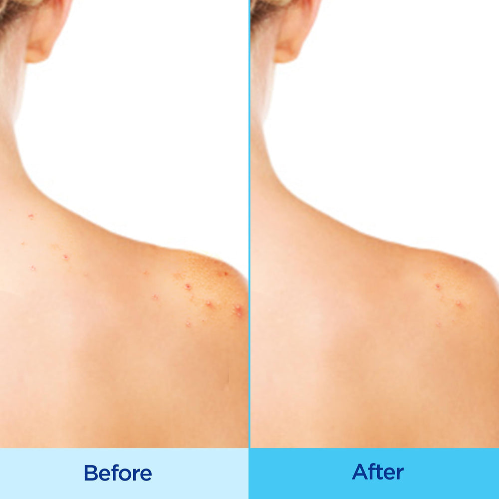 Back shoulder use with 360° spray for thorough coverage during workouts.