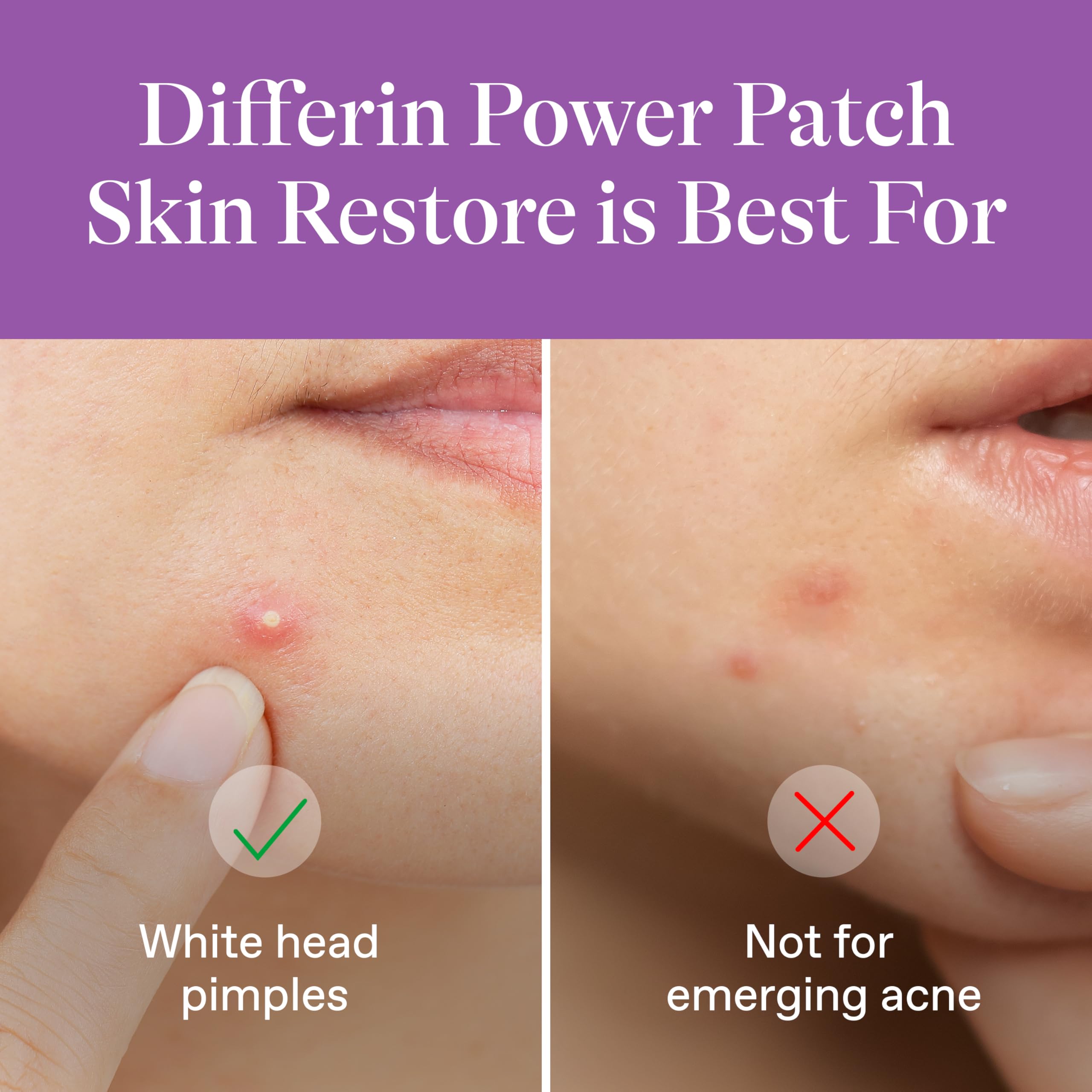 Small-size patch covers a tiny blemish for precise coverage.