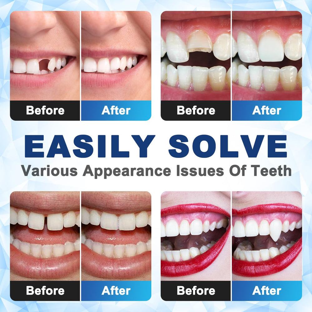 Soft material beads from DILLNALA that conform to tooth contours for comfort