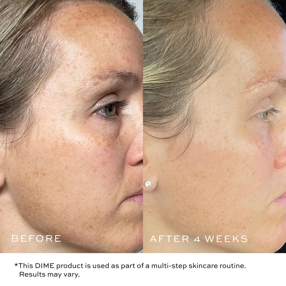 DIME Bakuchiol anti-wrinkle ingredients closeup illustrating gentle retinol alternative.