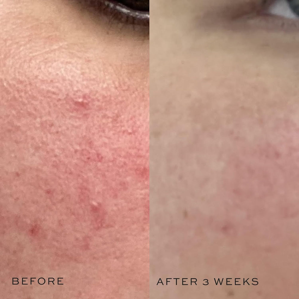 DIME Super Skin Toner with witch hazel and hyaluronic acid soothing complexion