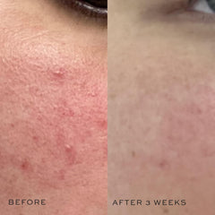 DIME Super Skin Toner with witch hazel and hyaluronic acid soothing complexion