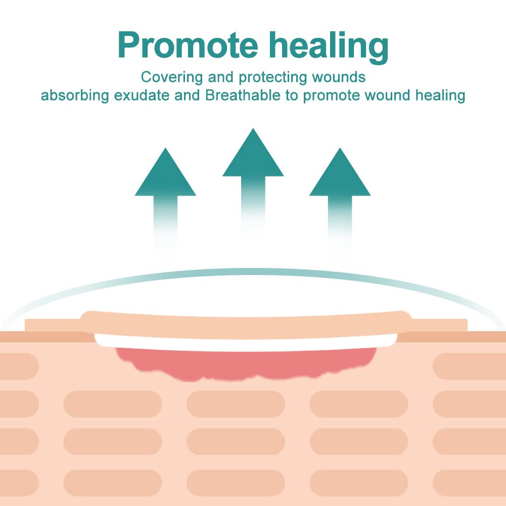 Dimora border 7x7 dressing fits moderate to high exudate wounds.