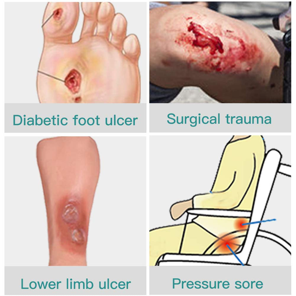 Dimora non-stick padding reduces friction during removal
