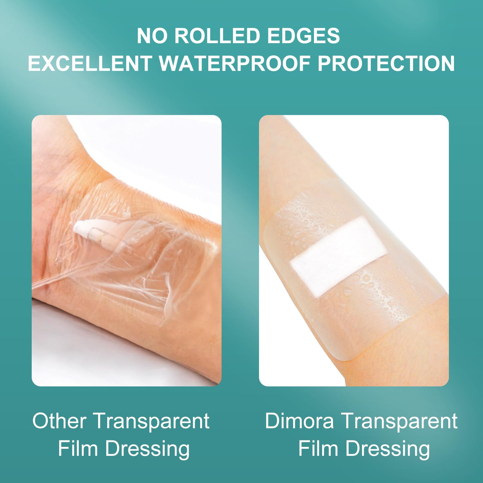 Dimora dressing applied to forearm demonstrates secure adhesion during daily movement.