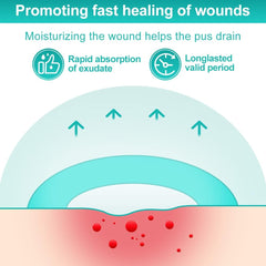 Dimora hydrocolloid dressing 4x4 self-adhesive patch helps secure wounds.