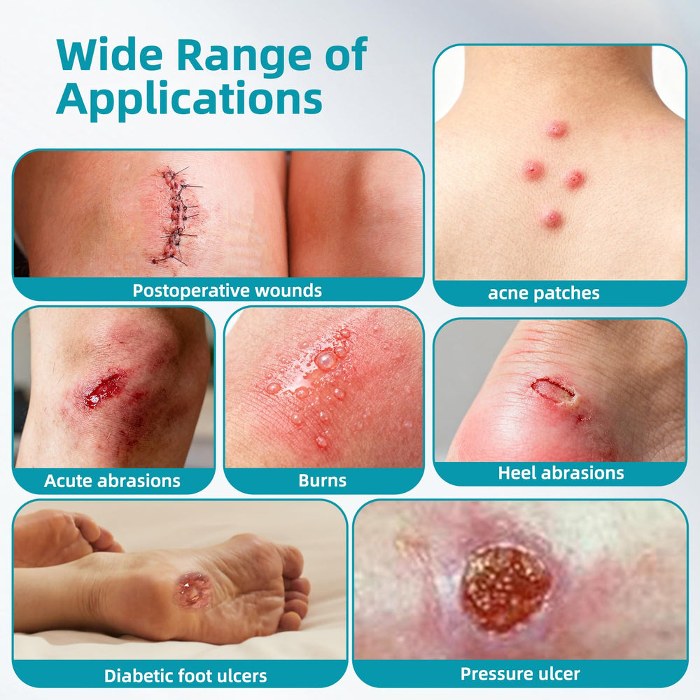 Dimora hydrocolloid dressing closeup shows texture and gentle adherence.