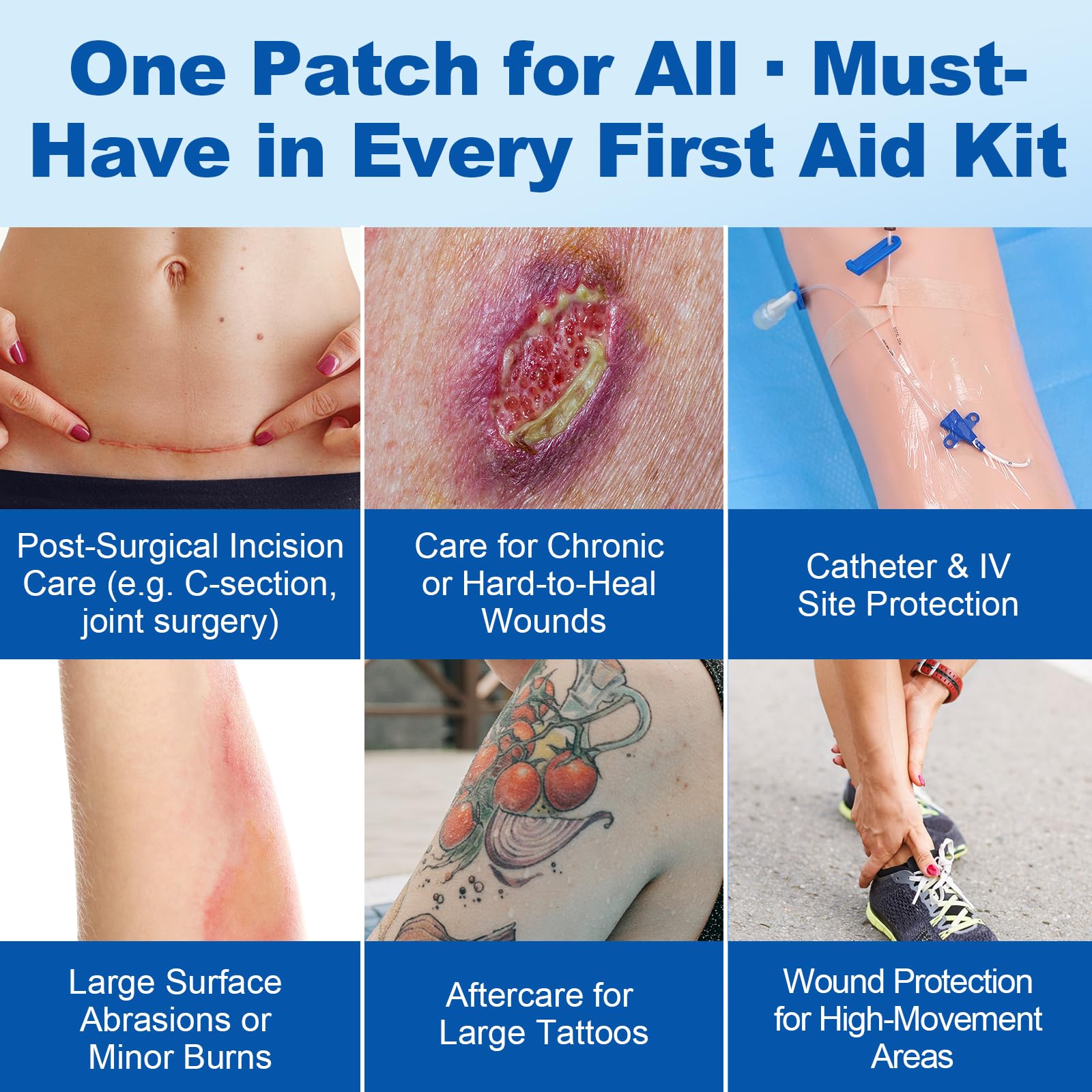Dimora post-surgical cover pad adapts to skin around donor sites.