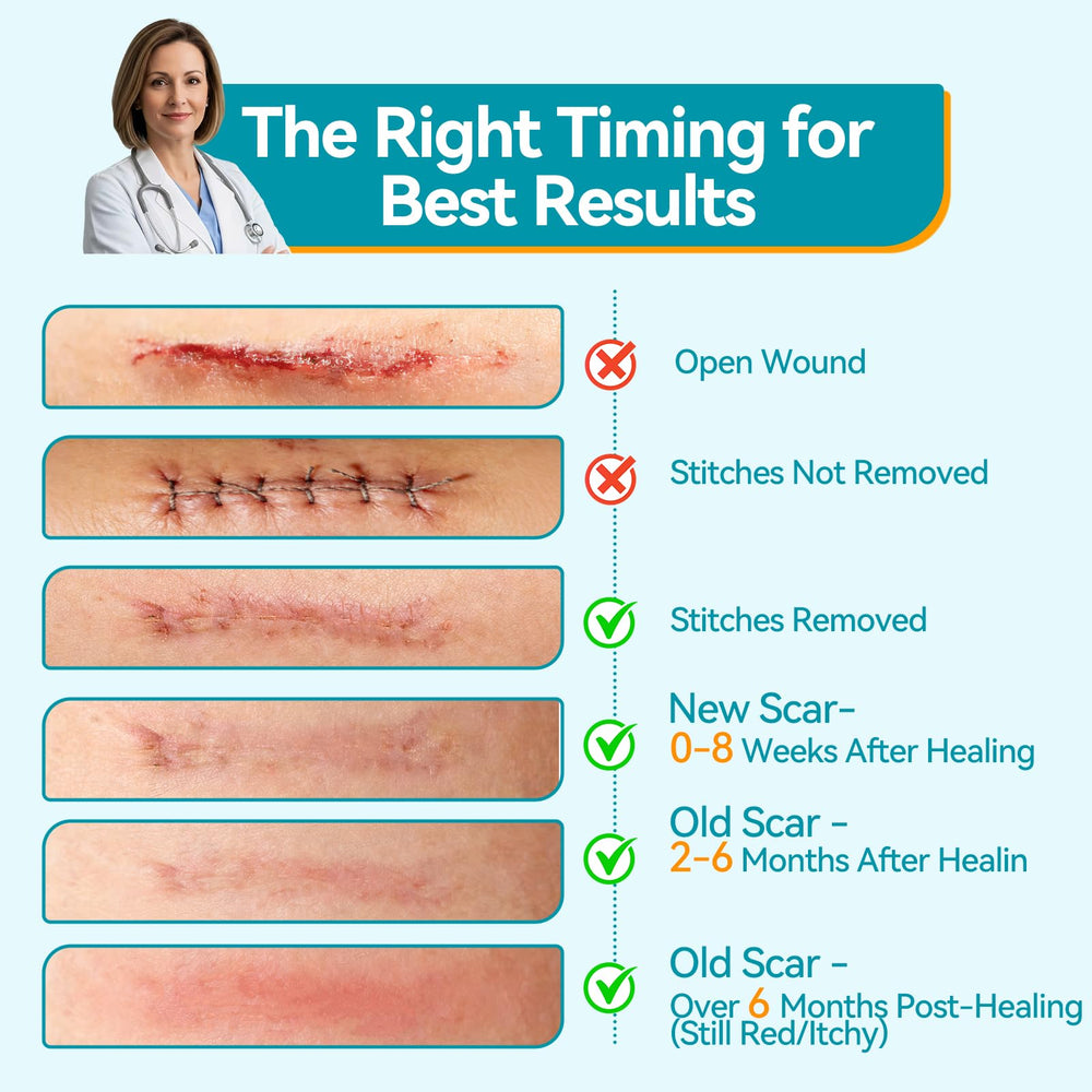 Dimora scar sheets suitable after surgery, burns, or C-section