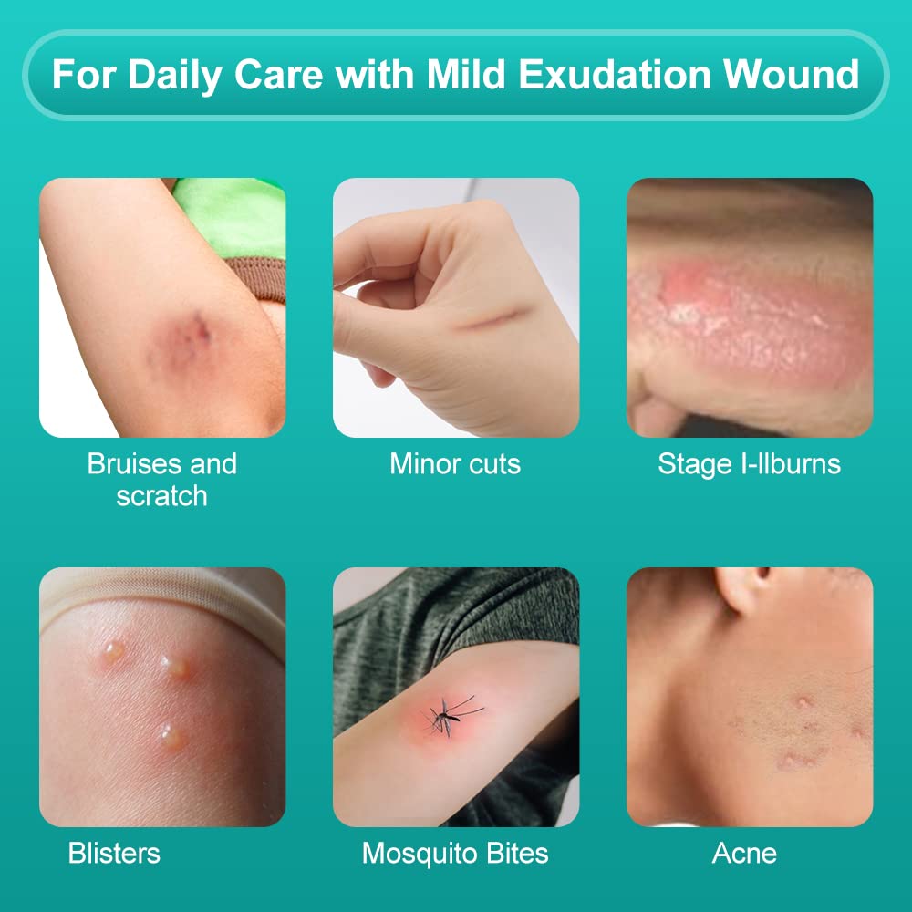 Dimora waterproof sterile wound dressing for everyday protection.