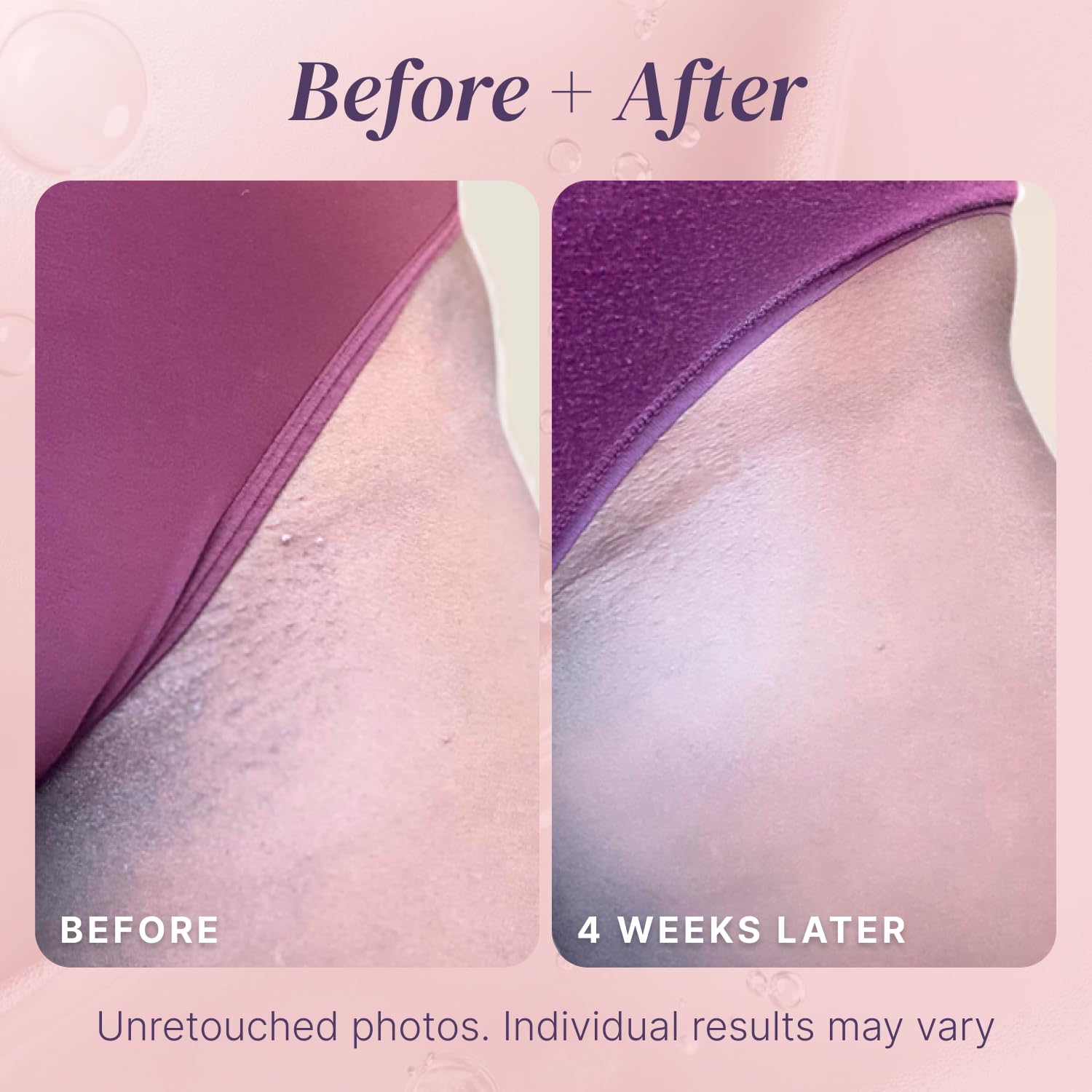 Divine Derriere Unisex Razor Bump Treatment displayed on various hands