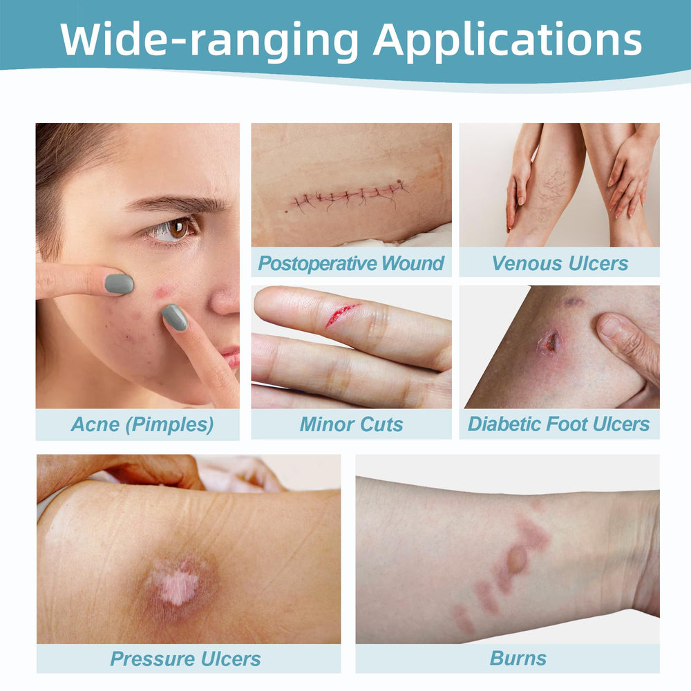 Dkmord hydrocolloid patch transparency lets you monitor healing progress.