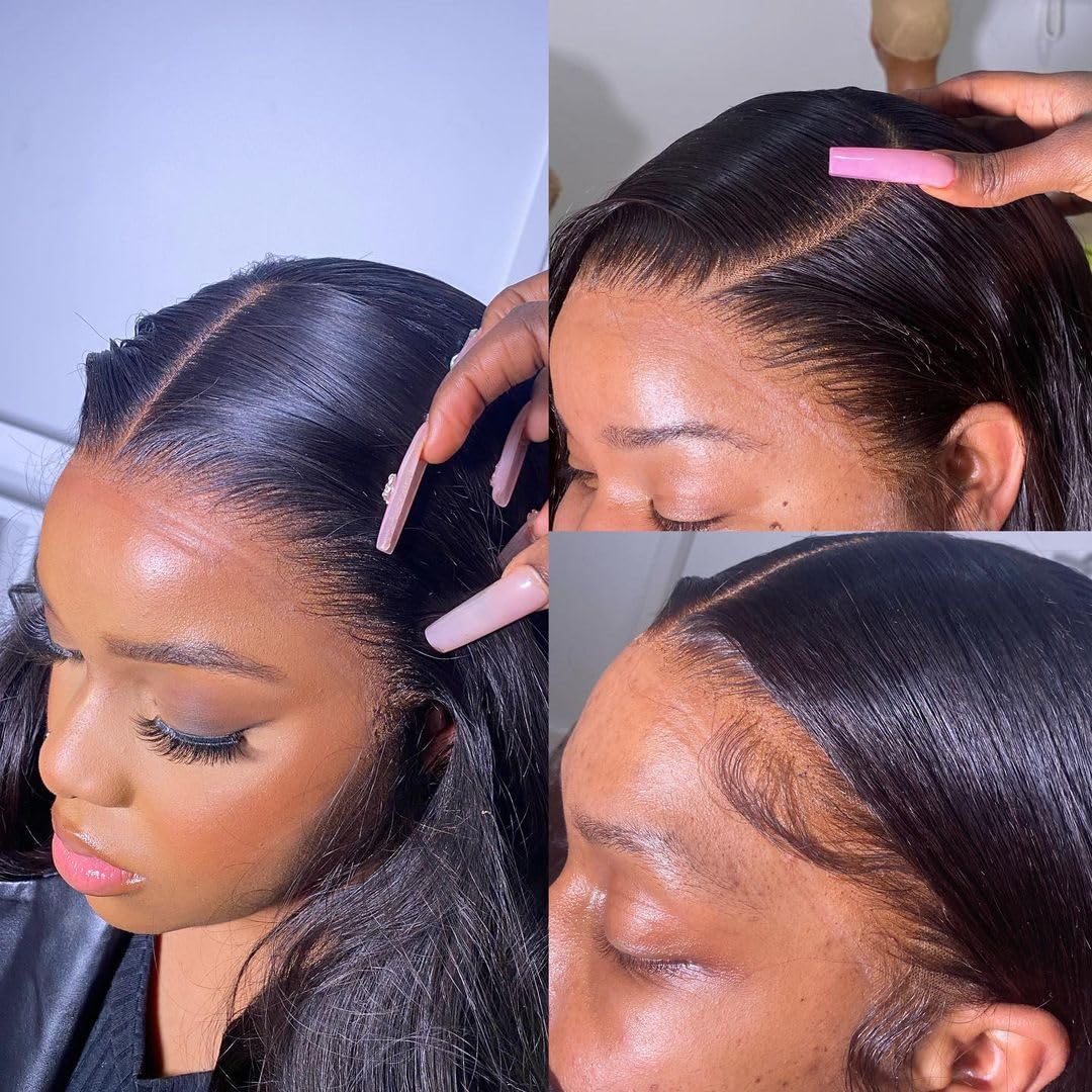 Dolahair remover being used to ease removal at the hairline