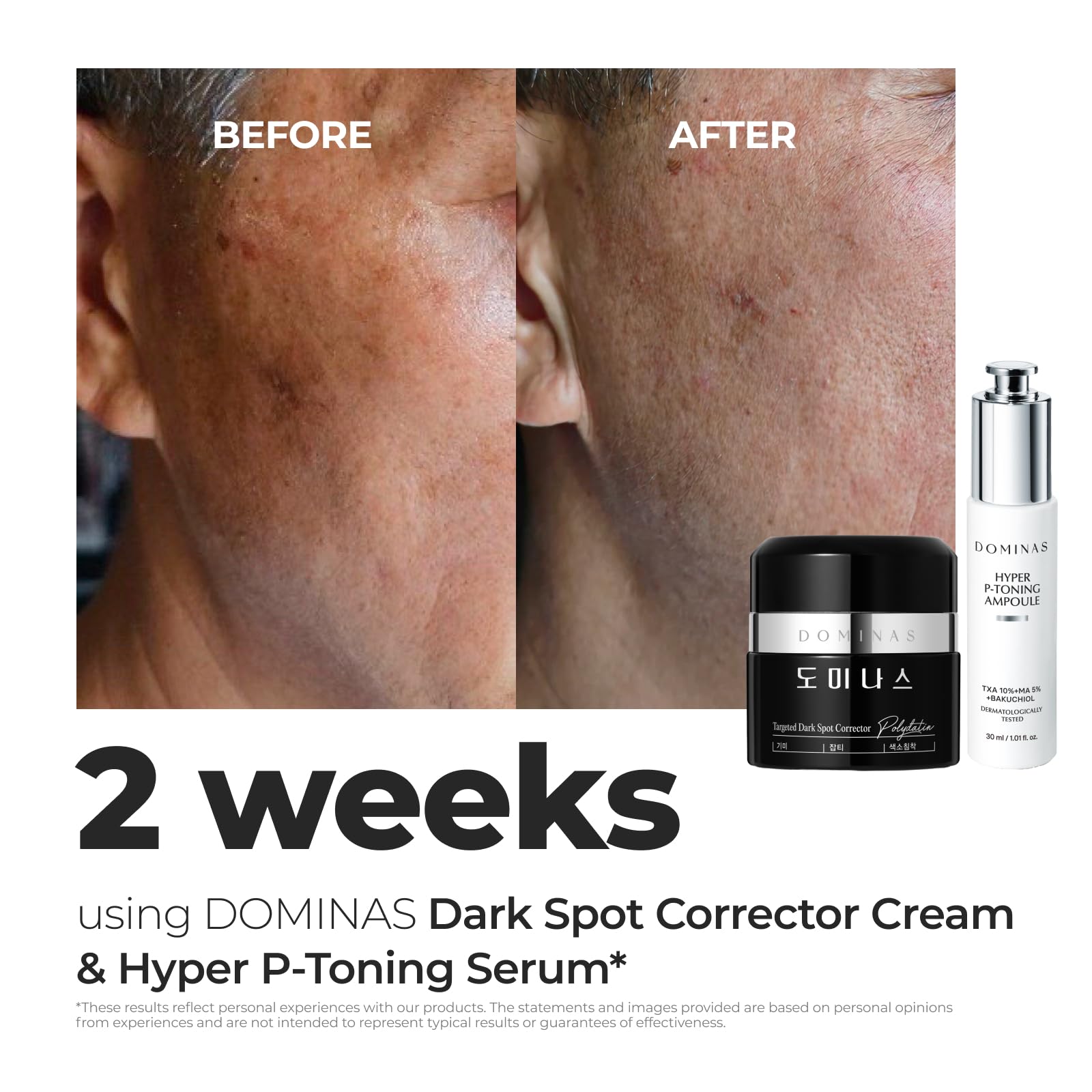 Dominas Dark Spot Corrector Cream on the face during application for gentle absorption.