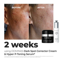 Dominas Dark Spot Corrector Cream on the face during application for gentle absorption.