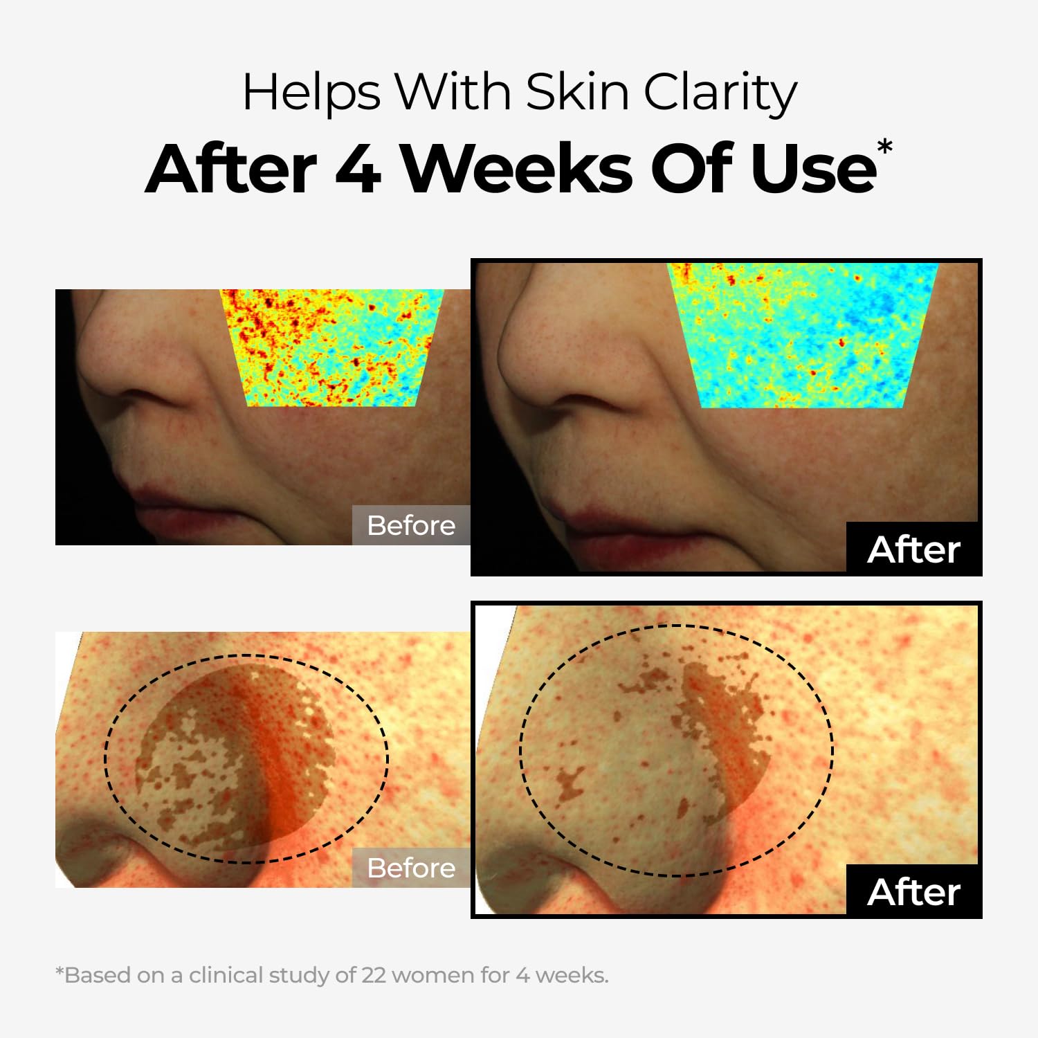 Dominas Dark Spot Corrector Cream with niacinamide ingredient suggesting tone improvement potential.