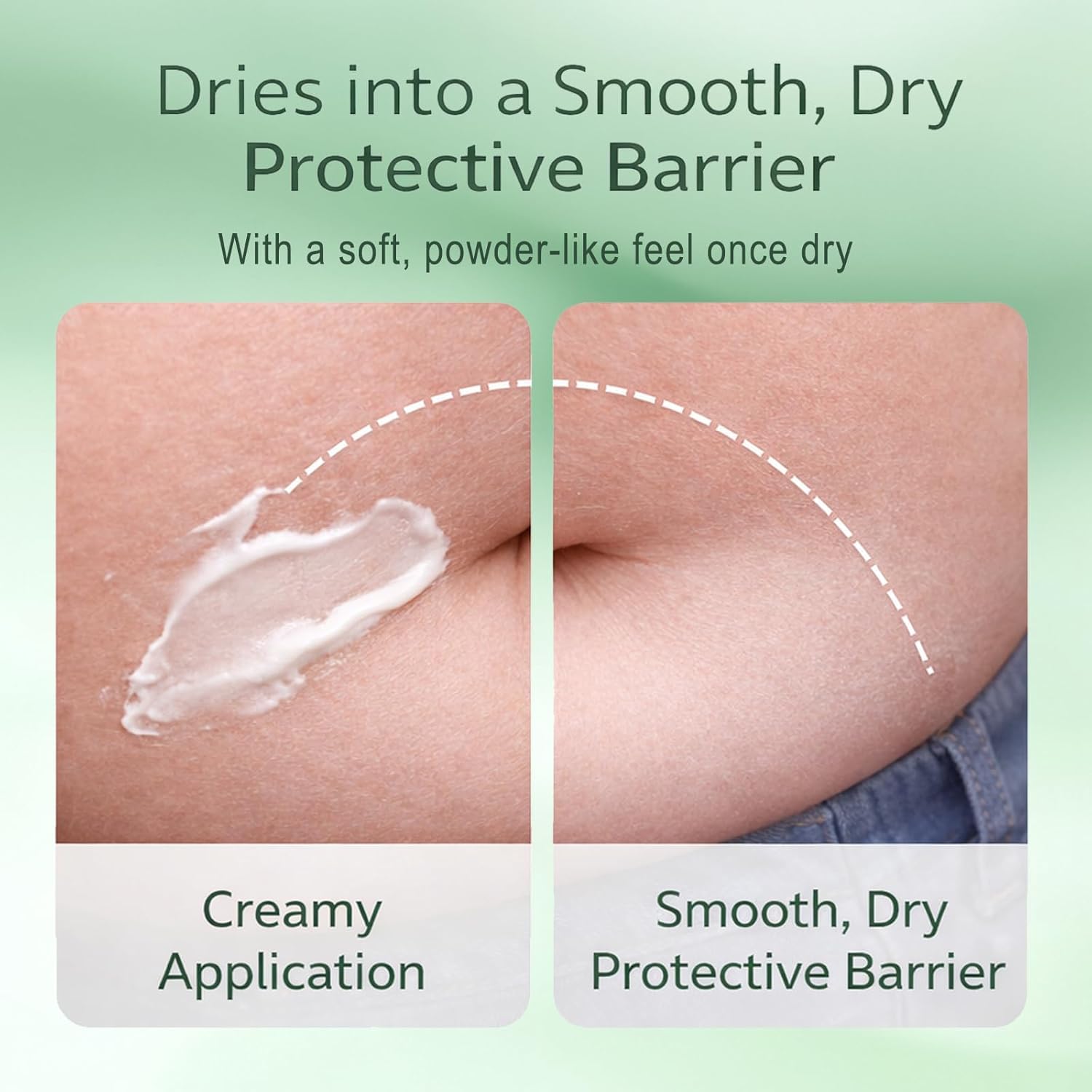 Dosoecse Healora Intertrigo Cream smoothed on skin to reduce rubbing
