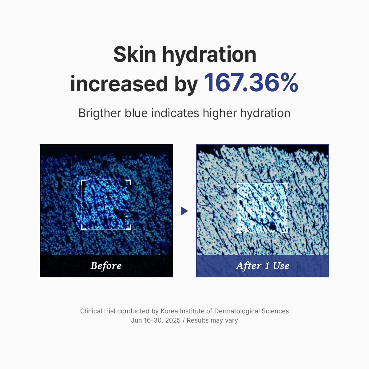 Hyaluronic acid in Dr.Althea Aqua Marine Watery Cream provides plump hydration.