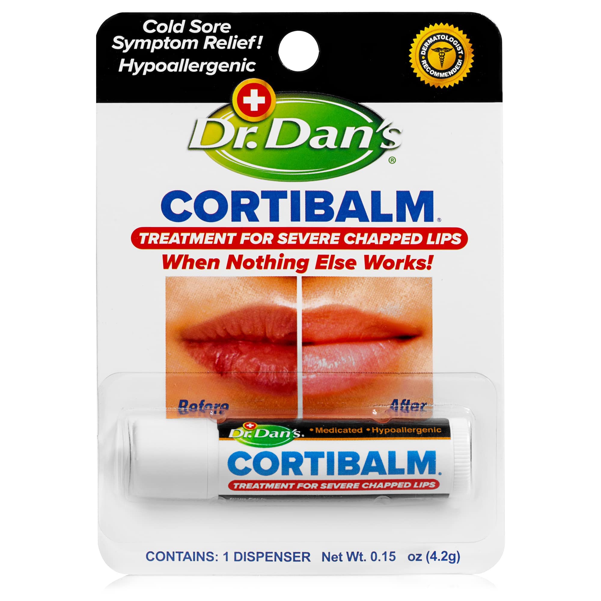 Dr. Dan’s Cortibalm tube-front: medicated lip balm for severely dry lips