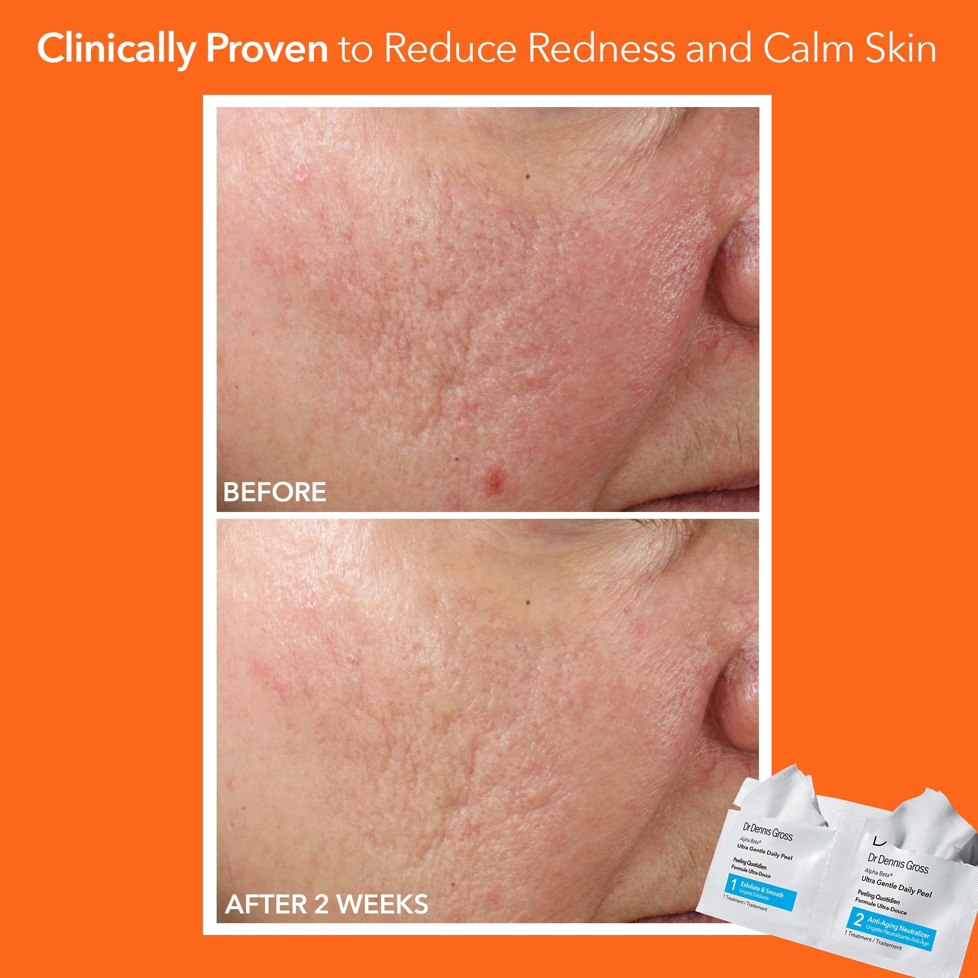 Close-up of exfoliant texture from the daily peel showing gentle action.