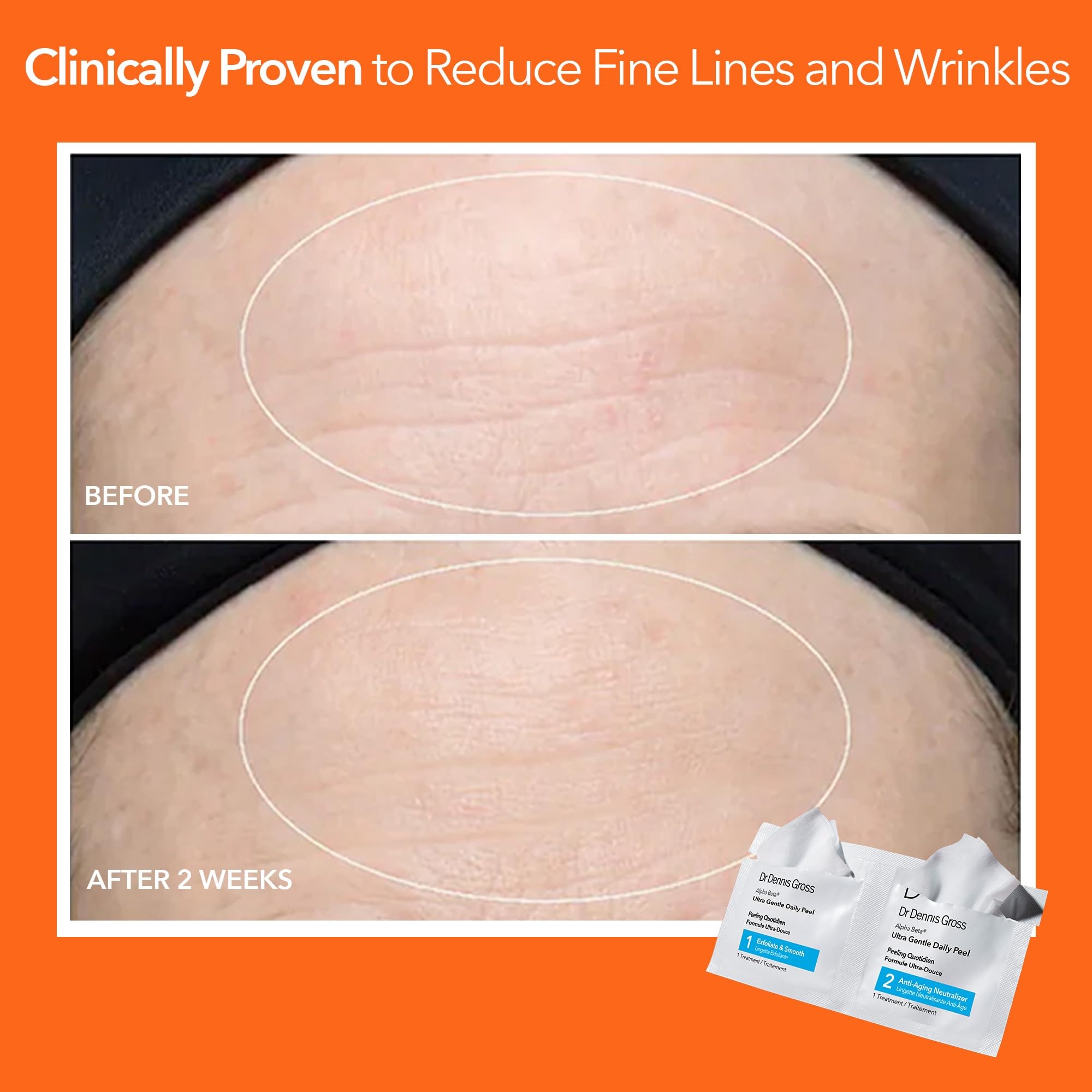 Illustration concept of improved pores and smoother texture from routine.