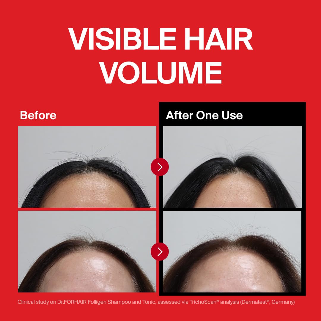 DR.FORHAIR Folligen Shampoo foam-lather highlights creamy texture ideal for gentle cleansing.