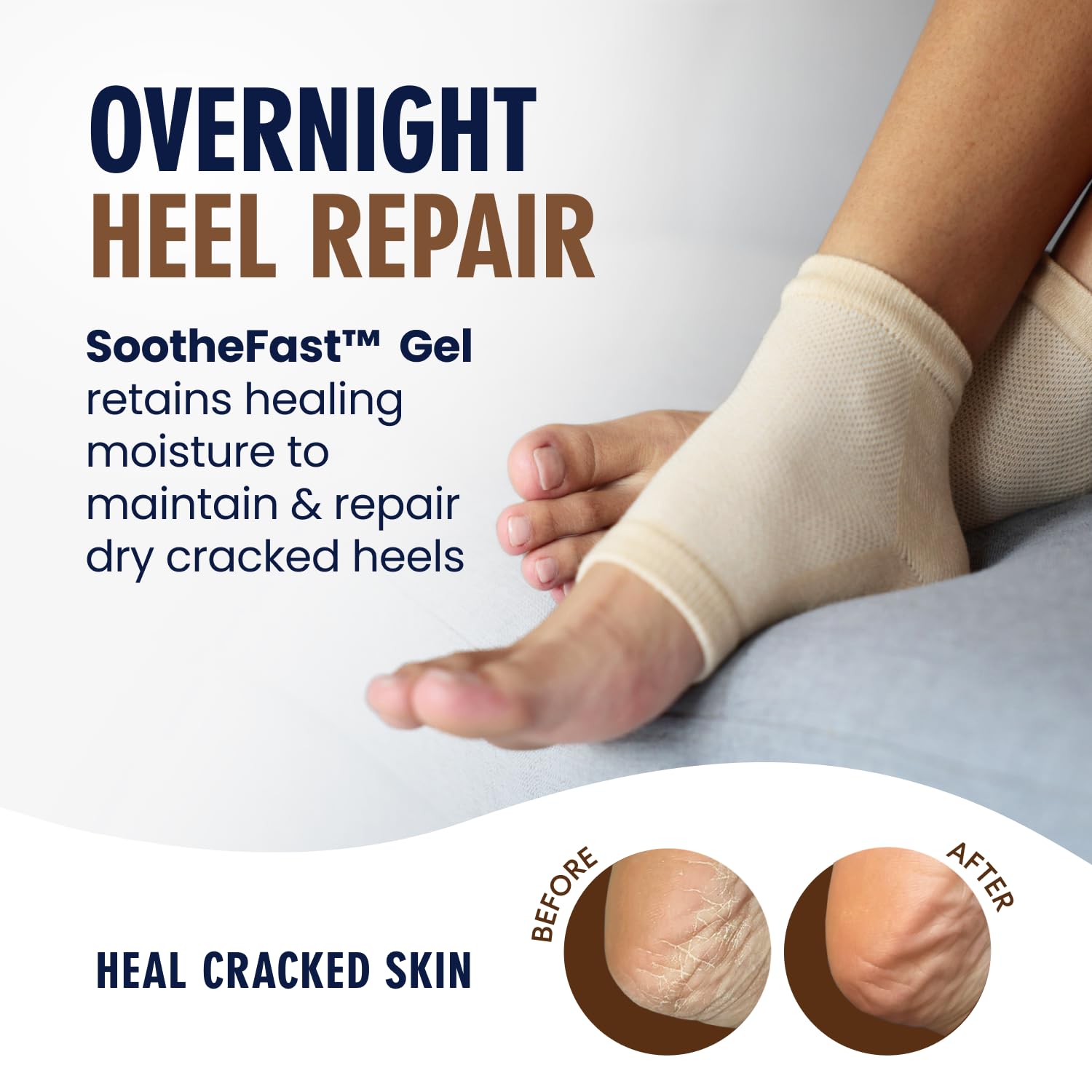 Dr. Frederick's Original open-toe heel socks show breathable all-night comfort.