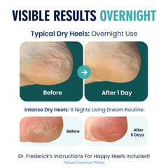 Open-toe cotton blend design keeps feet cool during wear.