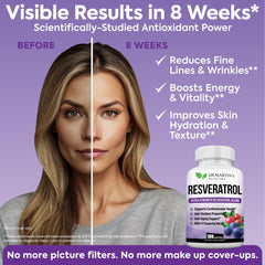 DR. MARTIN'S NUTRITION capsules on white background for easy daily dosing.