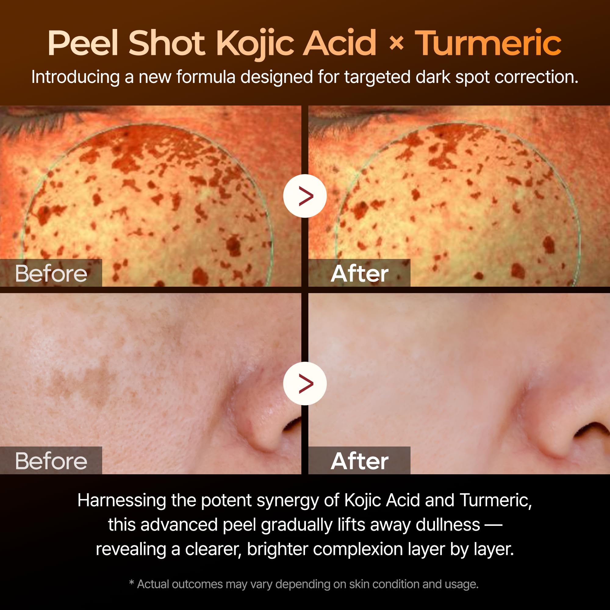 Dr. Melaxin Peel Shot serum pump close-up for even distribution.