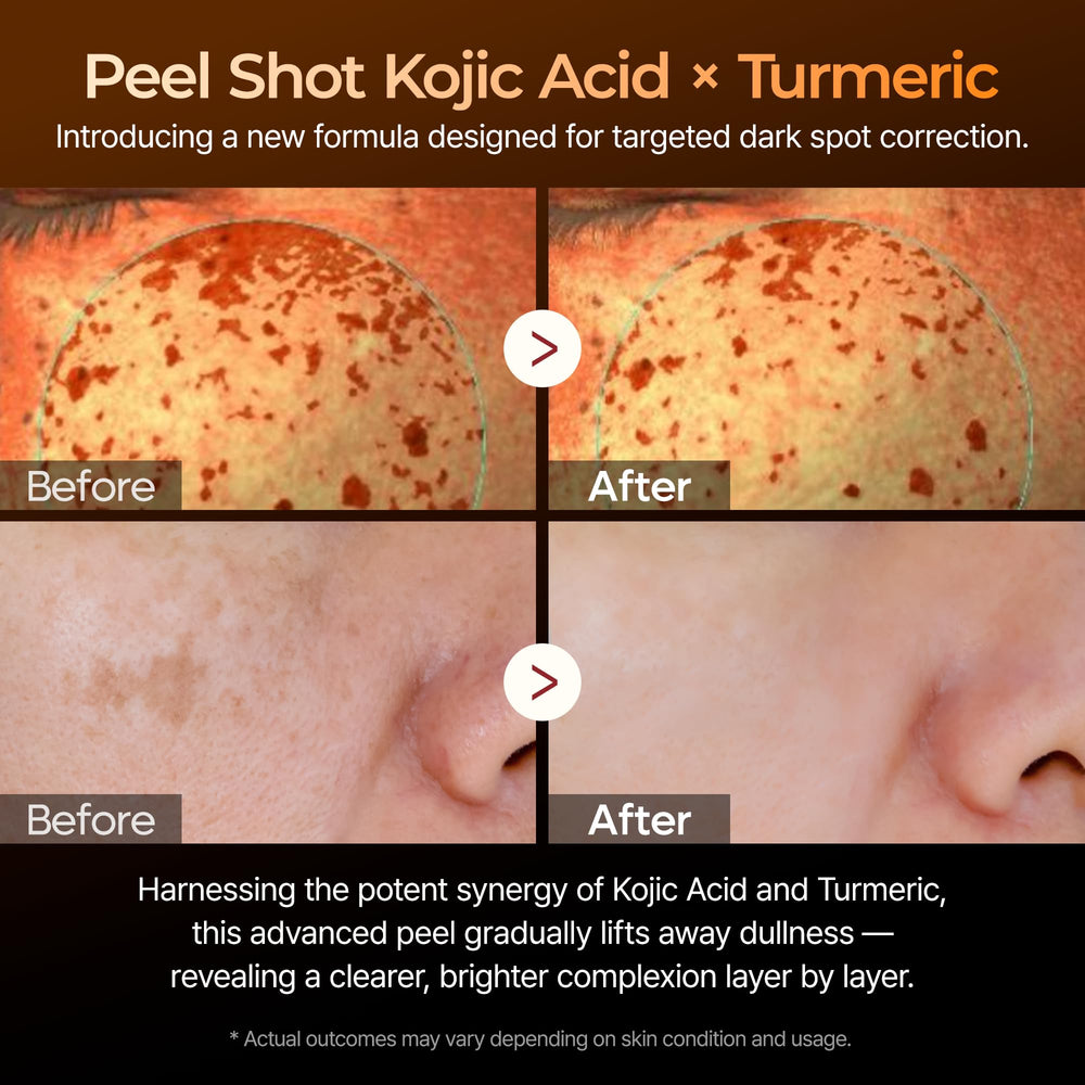 Dr. Melaxin Peel Shot serum pump close-up for even distribution.