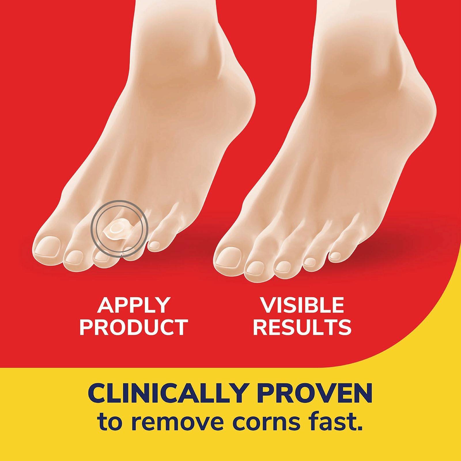 Product on foot illustrates protection from shoe pressure during movement