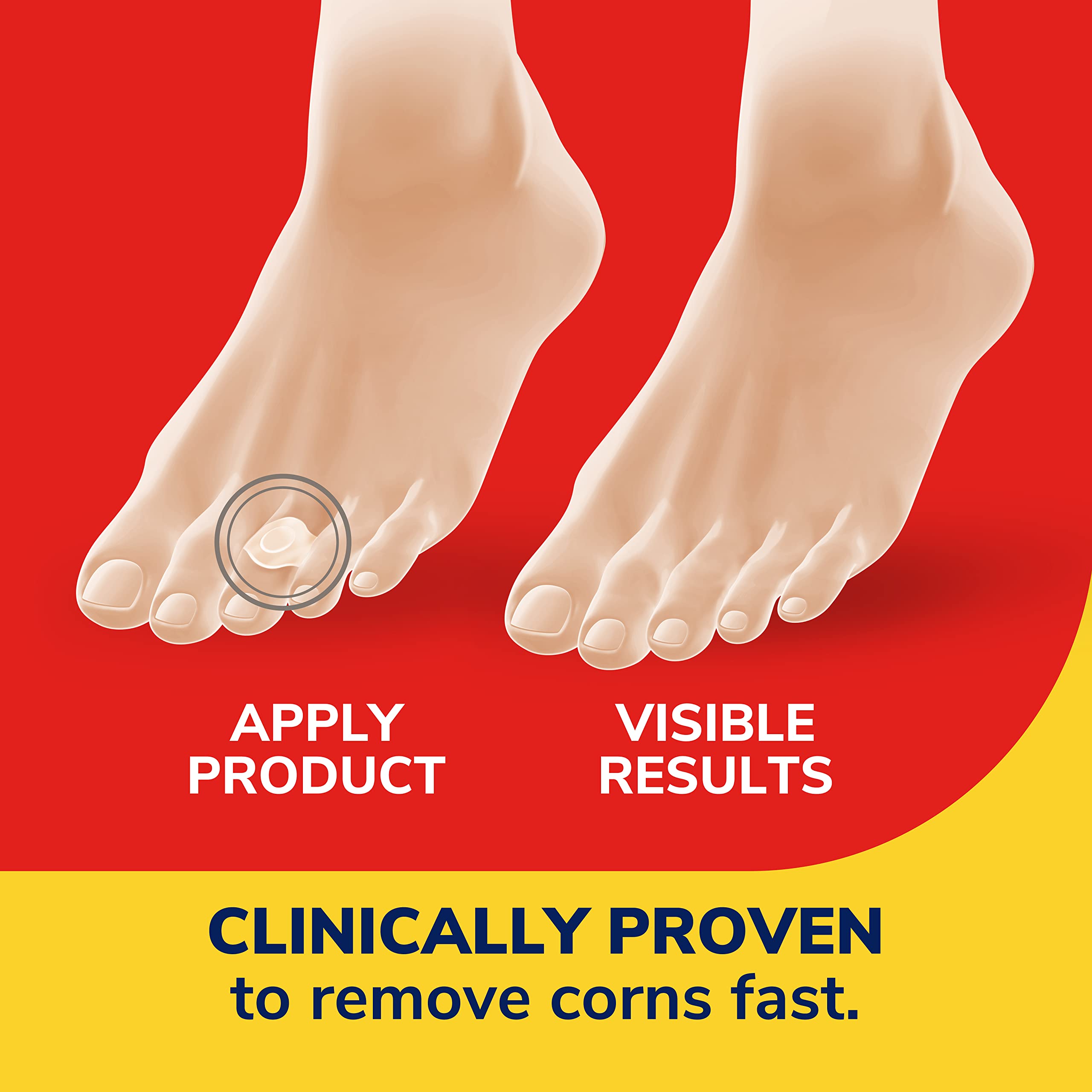 Step-by-step application image of Dr. Scholl's Corn Removers
