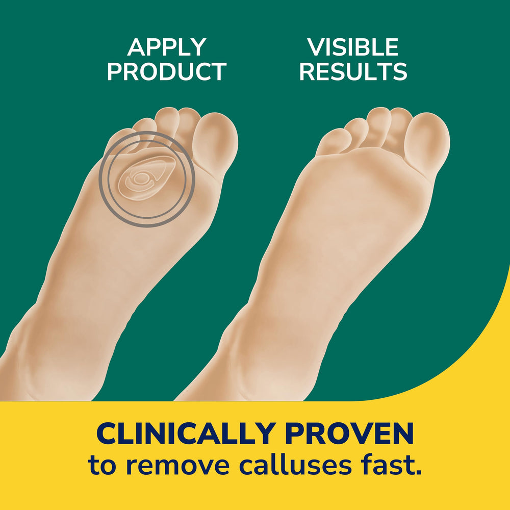 Discs on skin hint at immediate comfort from shoe pressure