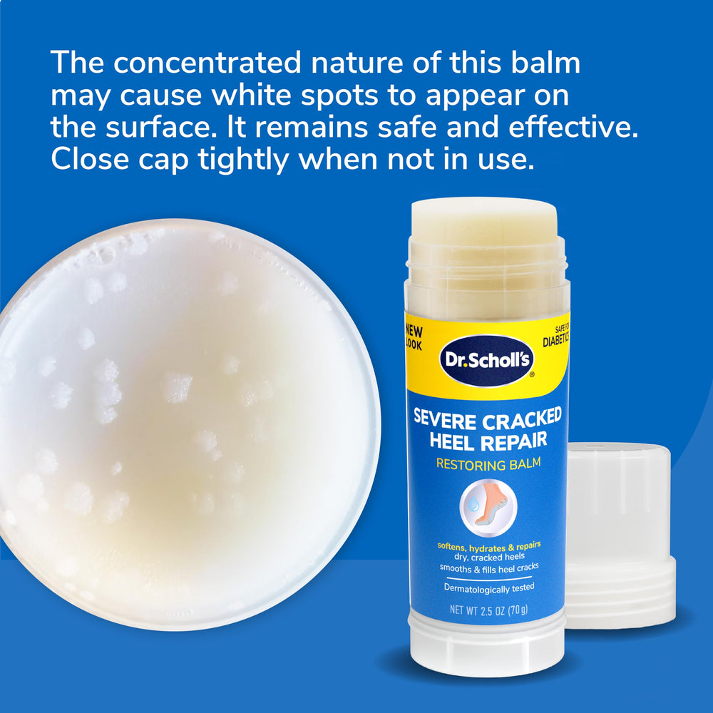 Home routine: applying Dr. Scholl's Balm to a clean heel.
