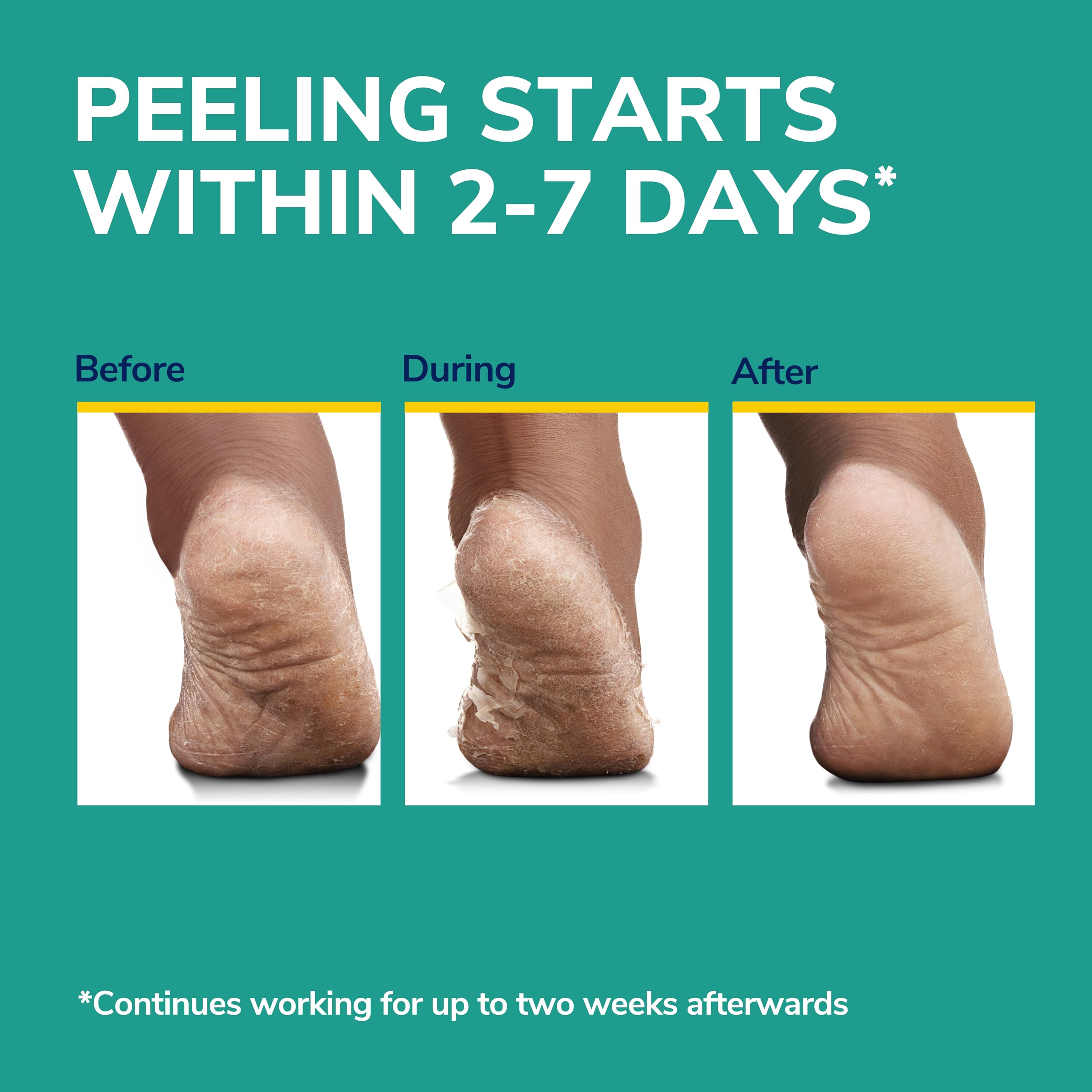 Urea-rich formula highlighting deep hydration for extremely dry feet.