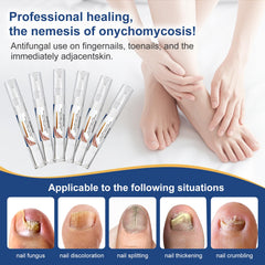 Drawzone nail pen with rotating brush enabling precise application.