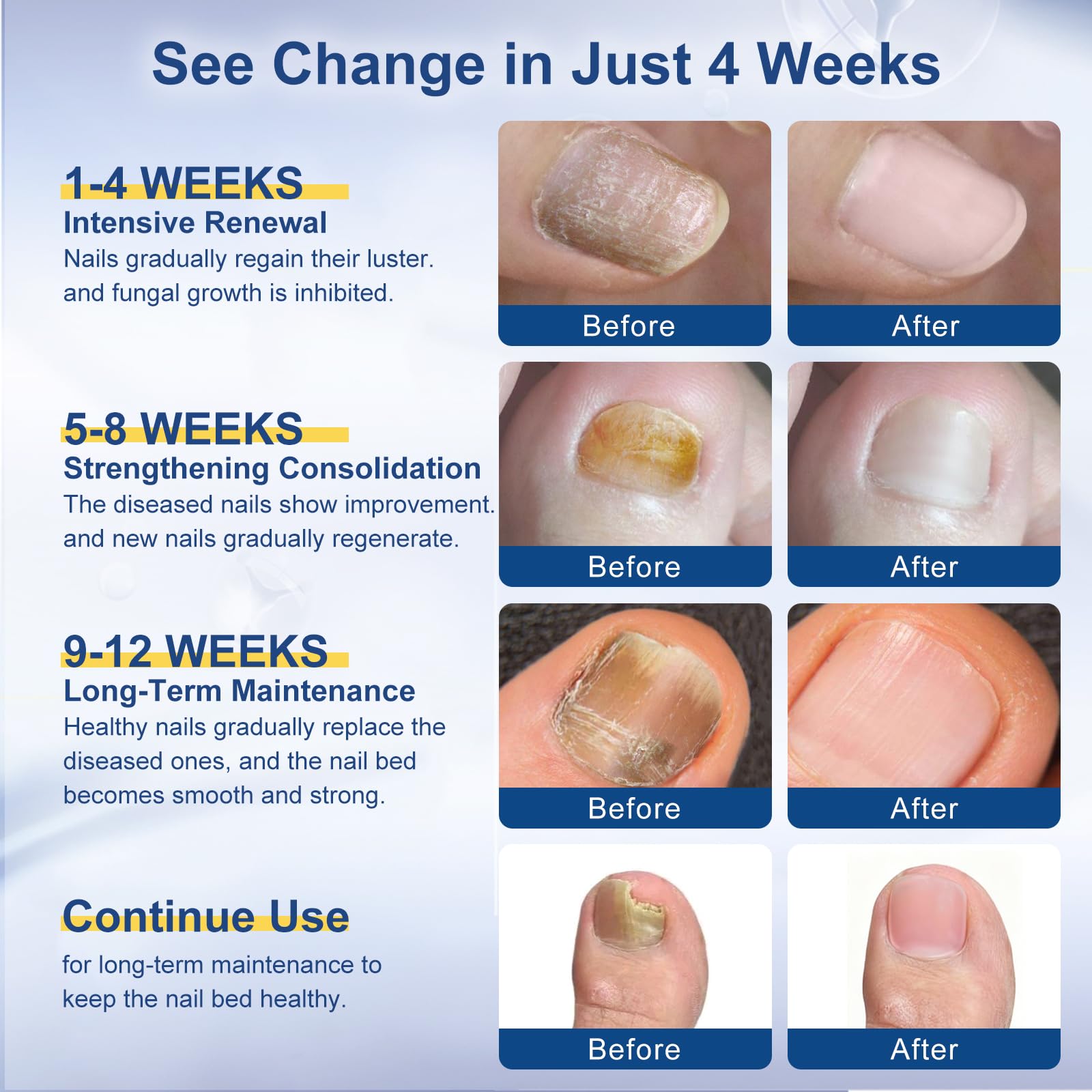 Drawzone product combines tolnaftate 1% for focused antifungal support.
